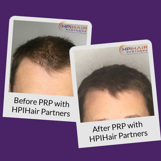 Healing Your Thinning Hair Naturally!