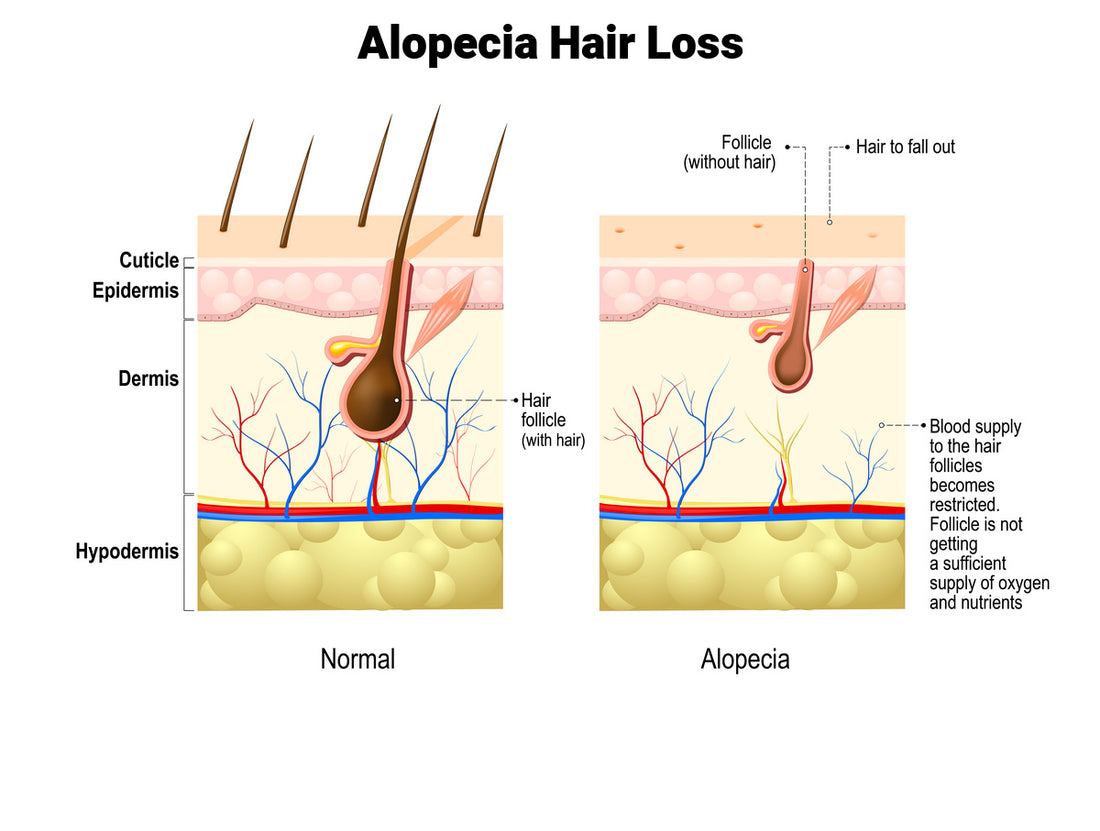 Successful Alopecia Areata Drug Trials!